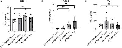 Comprehensive analysis of brain injury parameters in a preclinical porcine model of acute liver failure